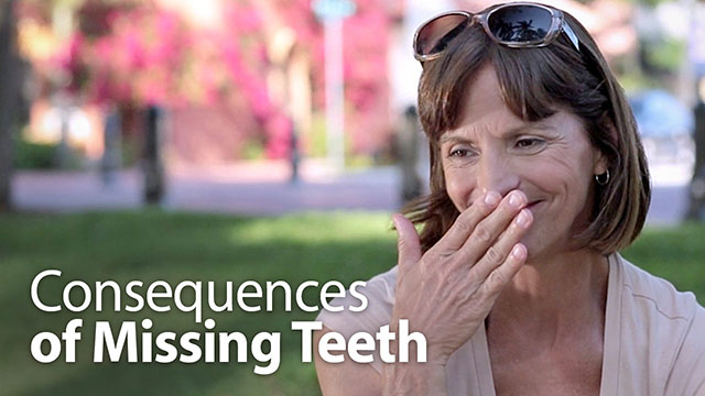Consequences of Missing Teeth Video