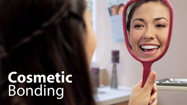Cosmetic Bonding Video