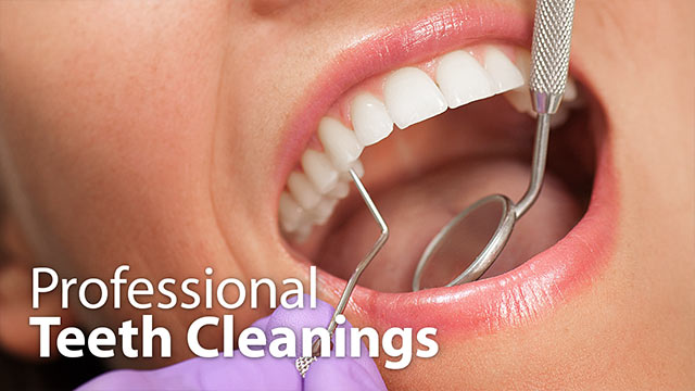 Professional Teeth Cleanings Video