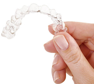 Invisalign Clear Aligners