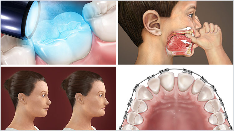 Dental Animations