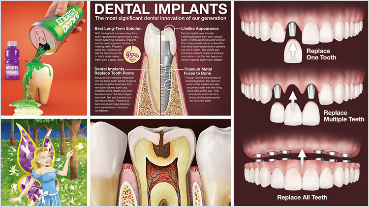 Dental Illustrations