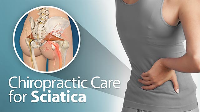 Chiropractic Care for Sciatica Video