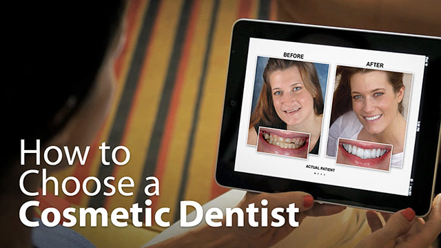 How To Choose A Cosmetic Dentist Video