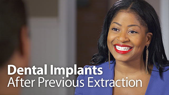 Dental Implants After Previous Tooth Extraction Video