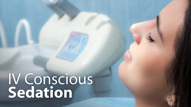 IV Conscious Sedation Video